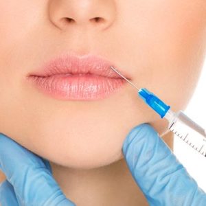 Filler Acido Ialuronico