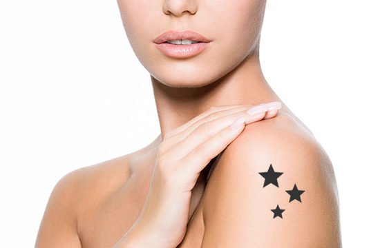 Rimozione Tatuaggi